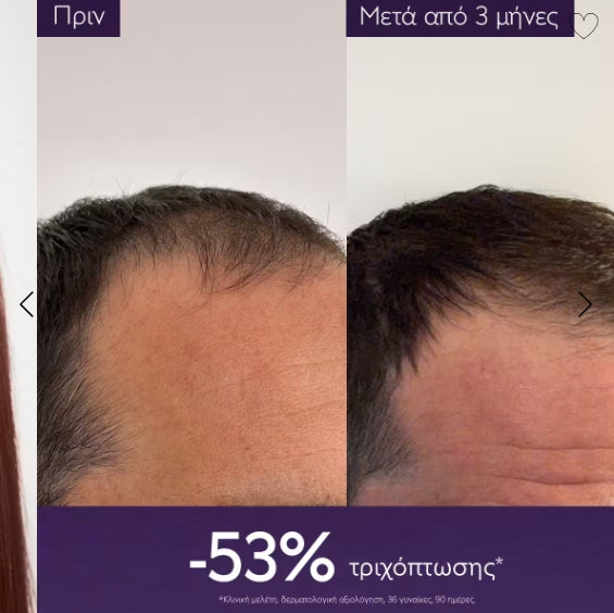Anti-Hair Loss Serum 50ml