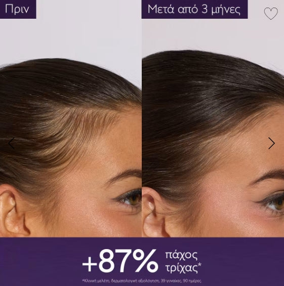 Anti-Hair Loss Serum 50ml