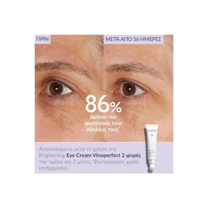 Caudalie Vinoperfect Κρέμα Ματιών κατά των Μαύρων Κύκλων για Λάμψη 15ml