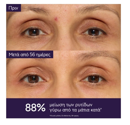 Caudalie Xmas Promo Ultimate Anti-Aging Solution με Premier Cru The Eye Cream Αντιγηραντική Κρέμα Ματιών,15ml & Δώρο Premier Cru The Serum Ορός Προσώπου, 10ml, & Premier Cru The Cream Αντιγηραντική Κρέμα Προσώπου, 15ml, 1σετ